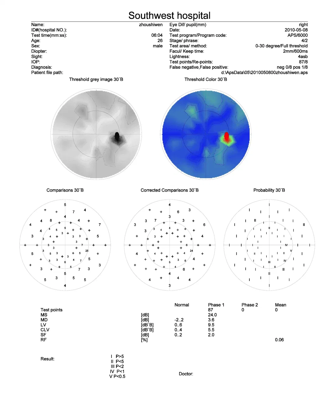 Vision Field Analyzer, Computerized Auto Perimeter, Visual Field Analyzer