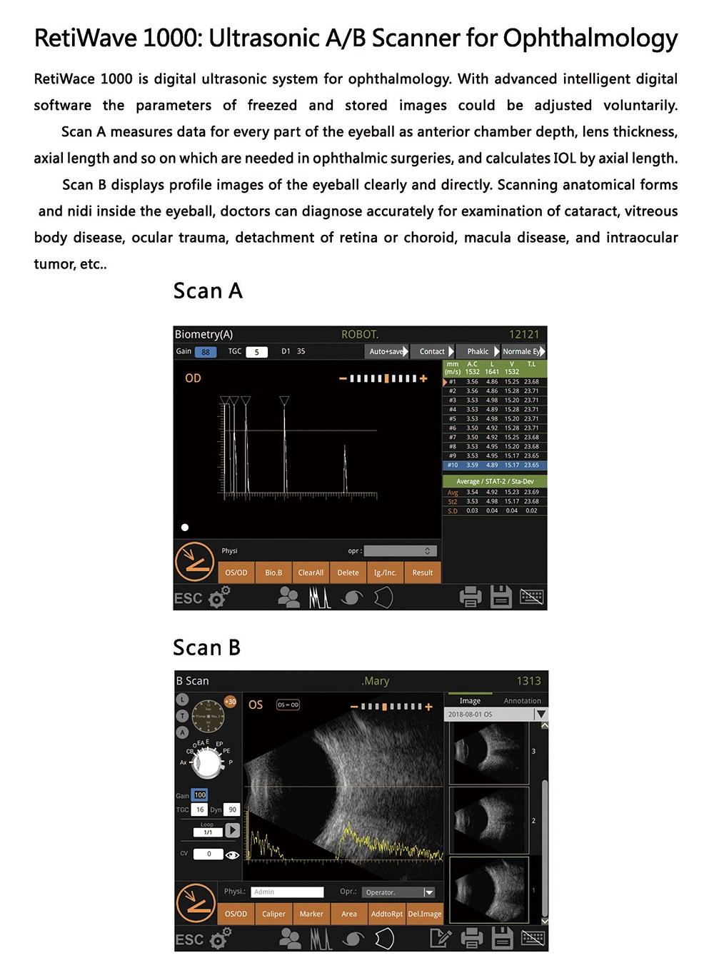 China Ophthalmic Machine Ab Scan Portable Ultrasound Scanner Retiwave 1000