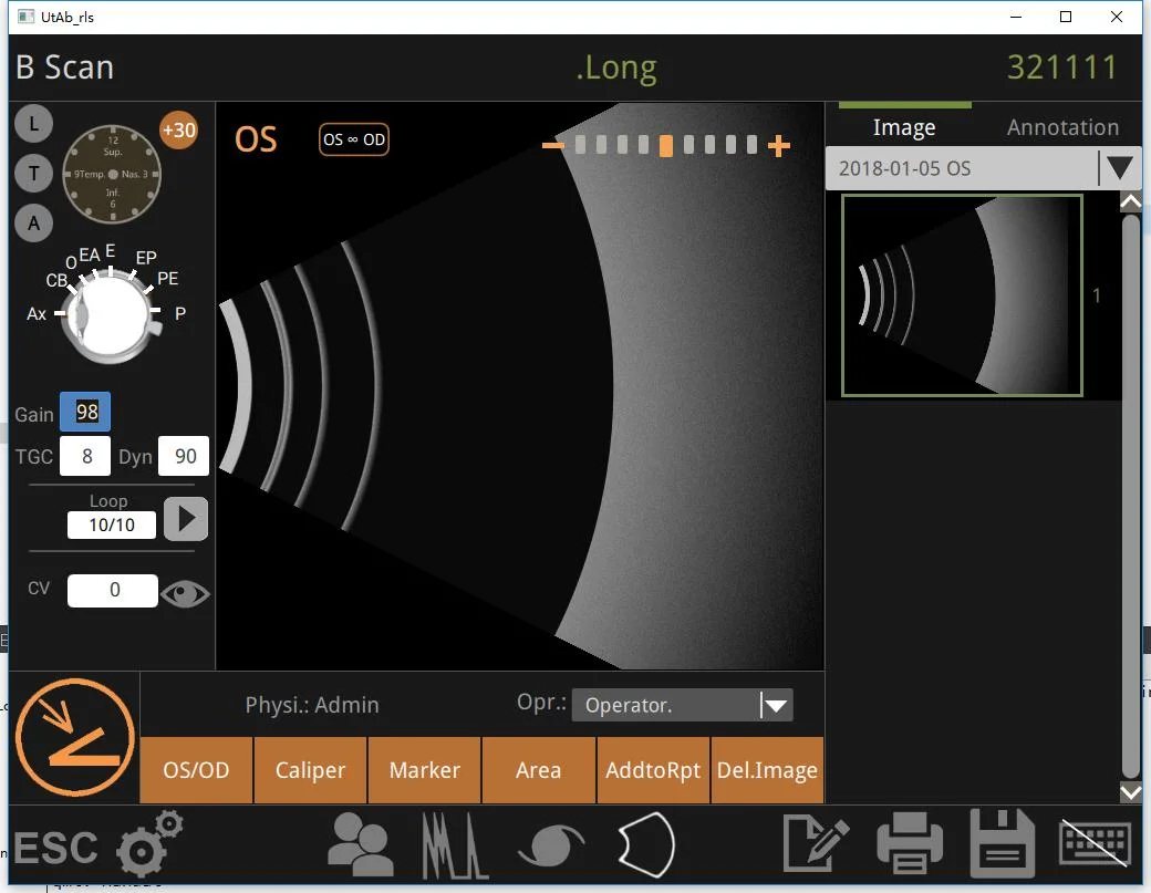 Optics High Quality Ophthalmic Ultrasonic Digital A/b Scanner Retiwave 1000 For Ophthalmology