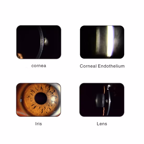 Lampe à fente numérique portable pour caméra ophtalmique de haute qualité
